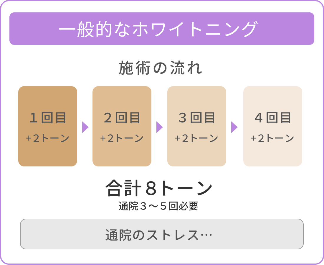 一般的なホワイトニング