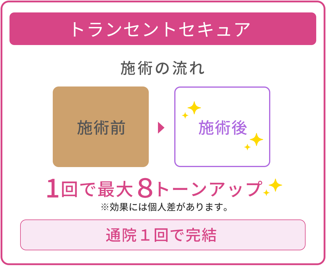 トランセントセキュア