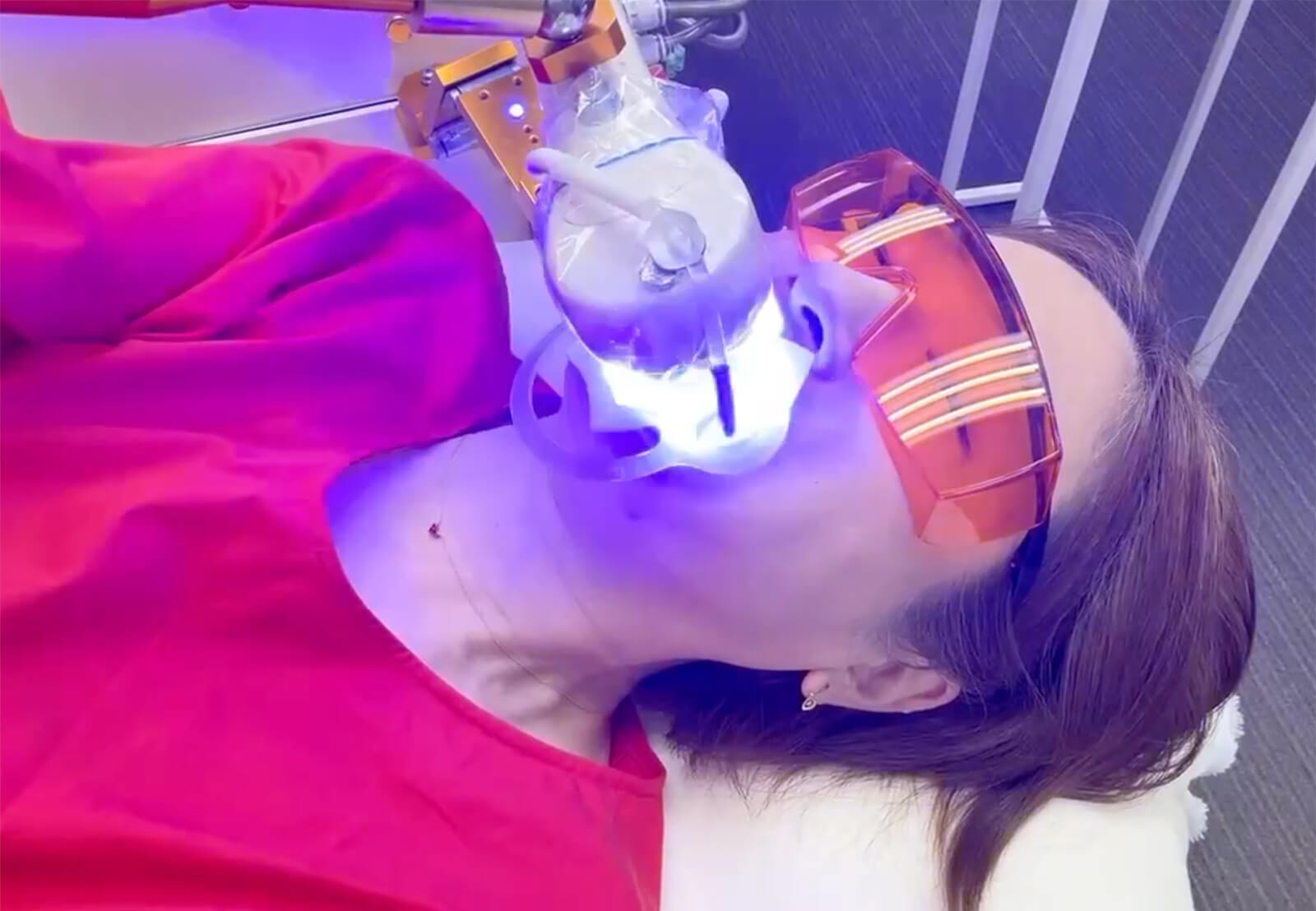 トランセントホワイトニングセキュア